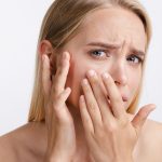 Kulit Kering dan Kusam Nggak Selalu Salah Skincare